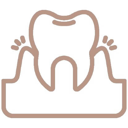 tooth aligment